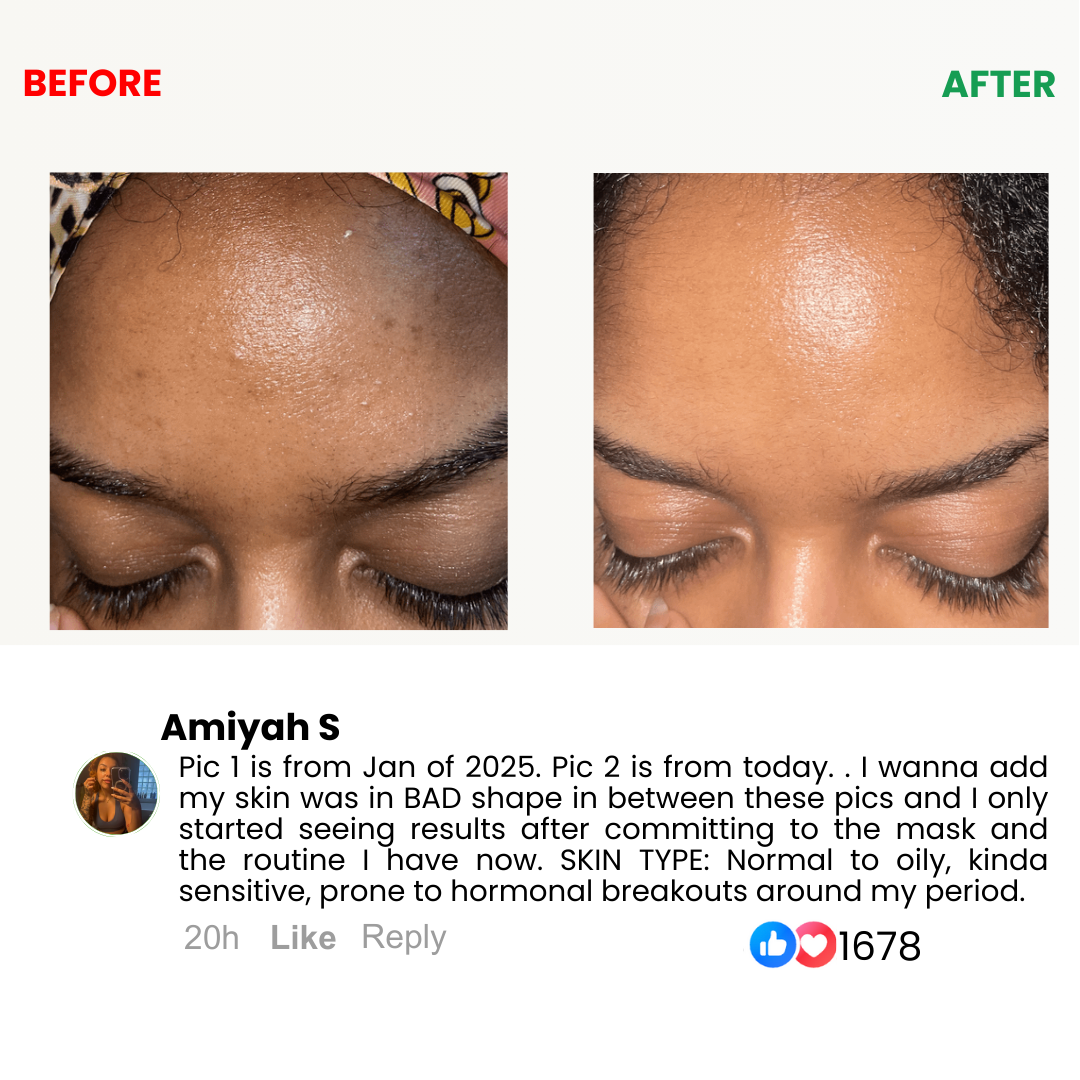 Kojic Acid Turmeric Overnight Mask