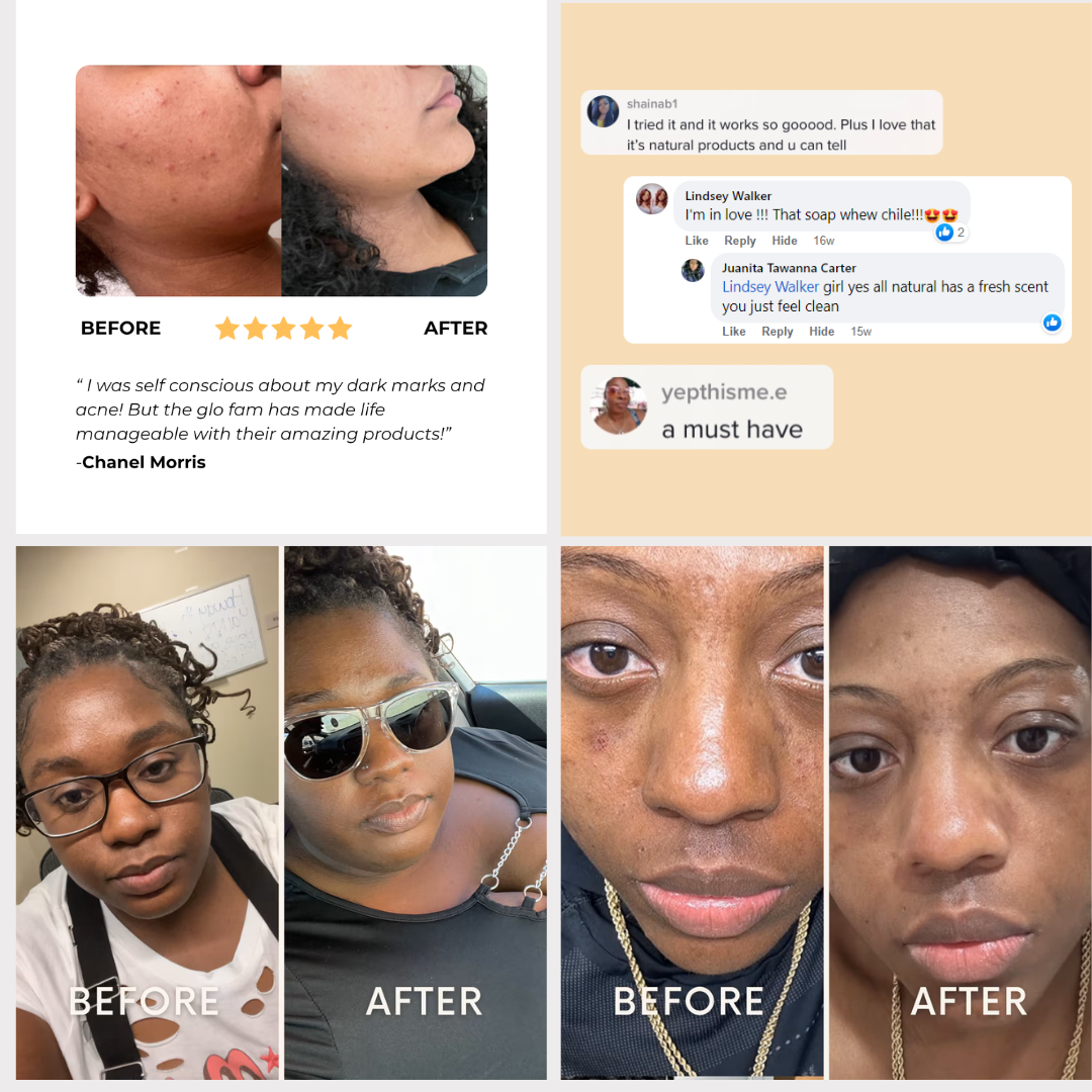 Kojic Acid Turmeric Overnight Mask