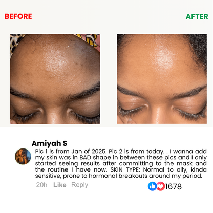Kojic Acid Turmeric Overnight  Mask