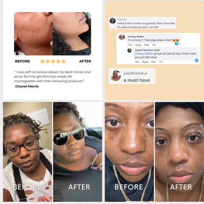 Kojic Acid Turmeric Overnight  Mask